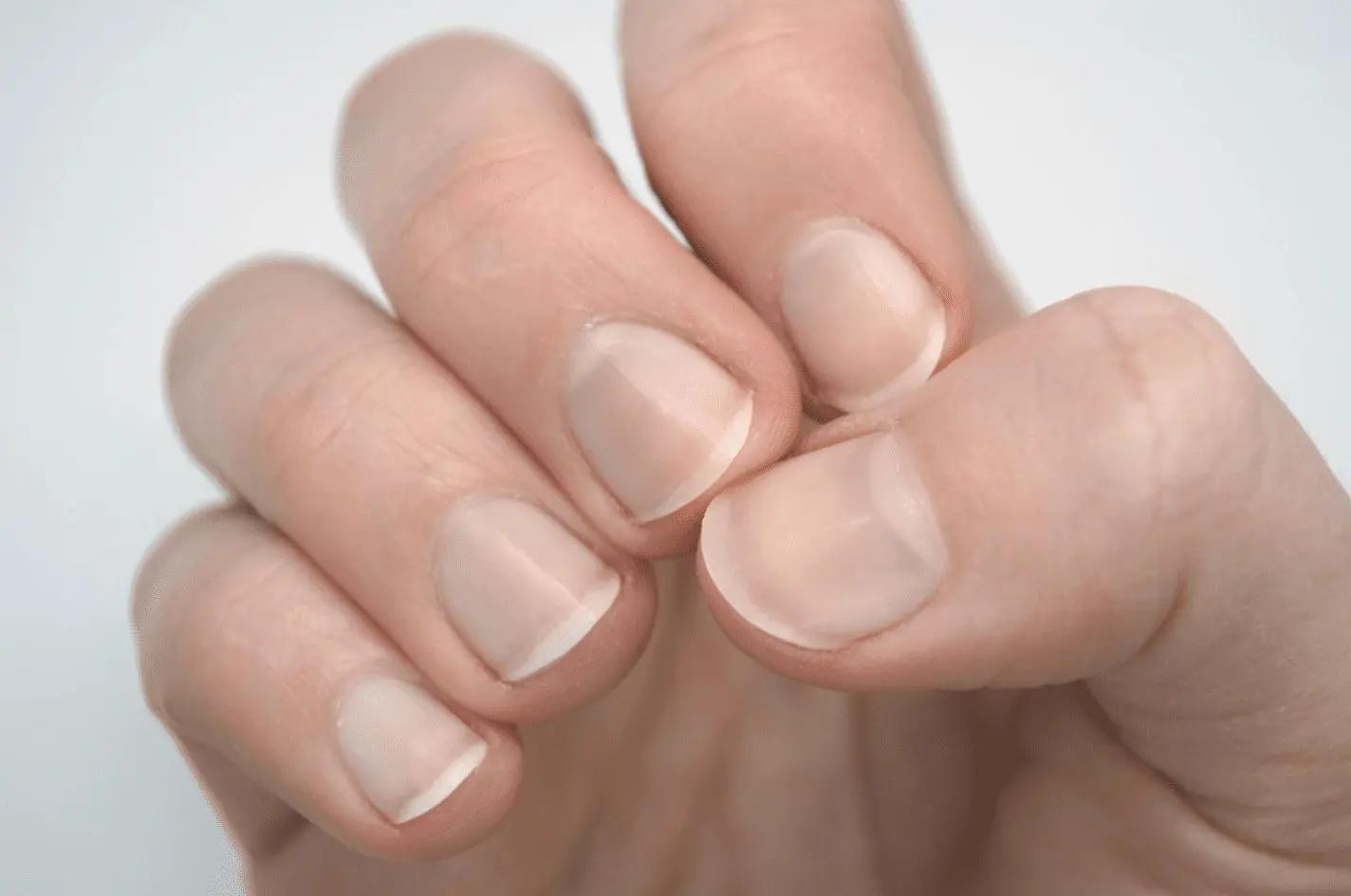 Protect and Preserve: Expert-Backed Strategies to Safeguard Your Natural Nails While Embracing Artistry