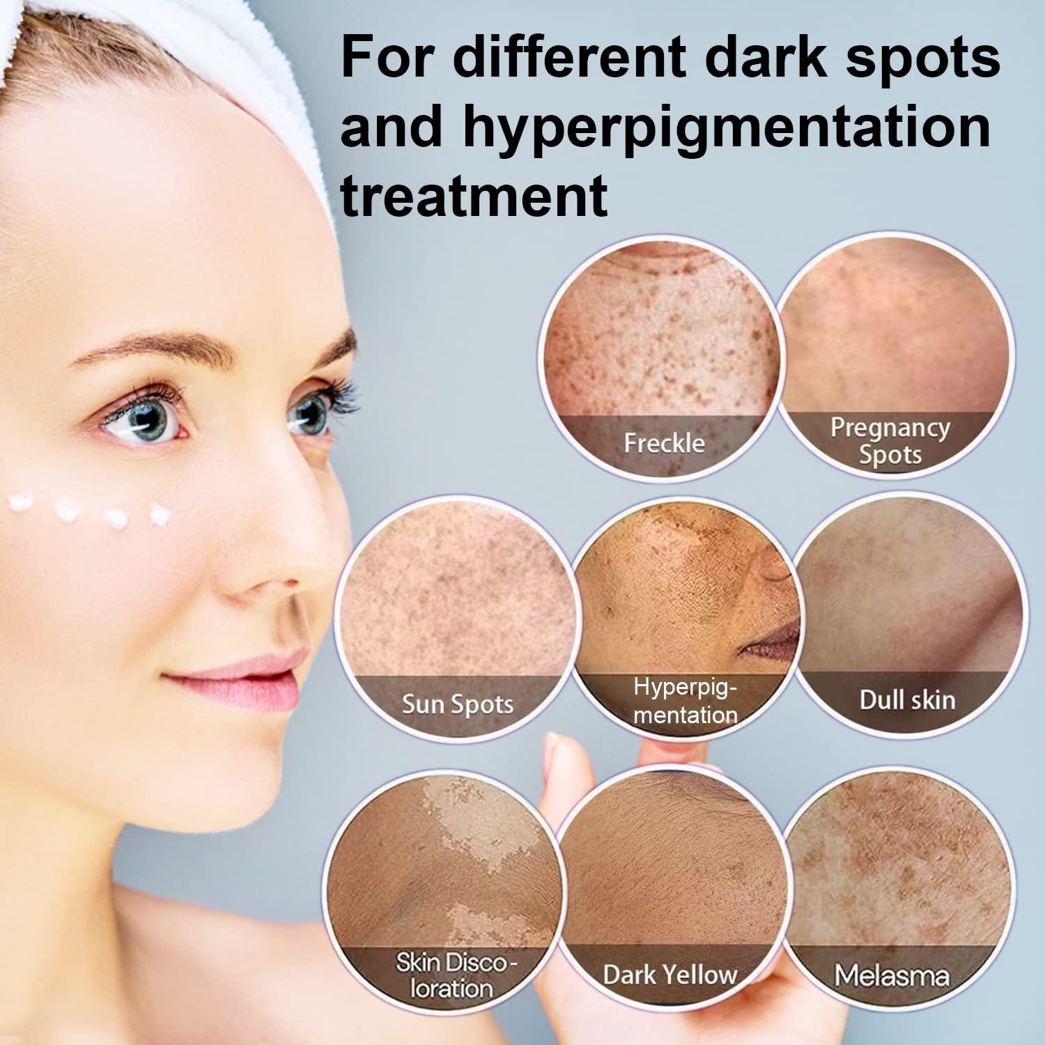 Understanding the Causes of Dark Spots and Pigmentation